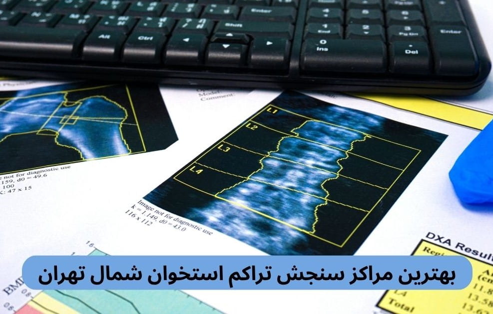 لیست بهترین مراکز سنجش تراکم استخوان شمال تهران به همراه آدرس و اطلاعات براساس نظرات مردم، دسترسی، کیفیت خدمات و موارد دیگر.