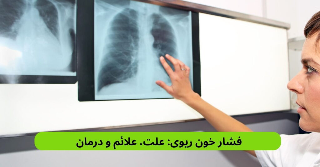 فشار خون ریوی یا هایپرتانسیون اختلالی است که در آن میزان فشار واردشده به رگهای خونی بین قلب و ریهها از حد طبیعی بیشتر میشود.