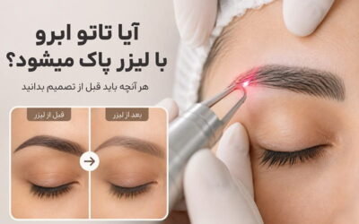 آیا تاتو ابرو با لیزر پاک می‌شود؟