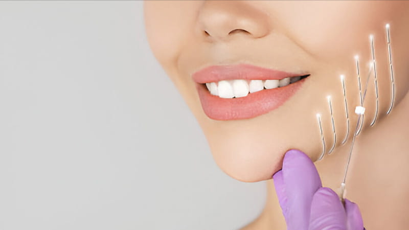 برای بهترین نتیجه لیفت با نخ در شیراز ، انتخاب پزشک چقدر مهم است؟