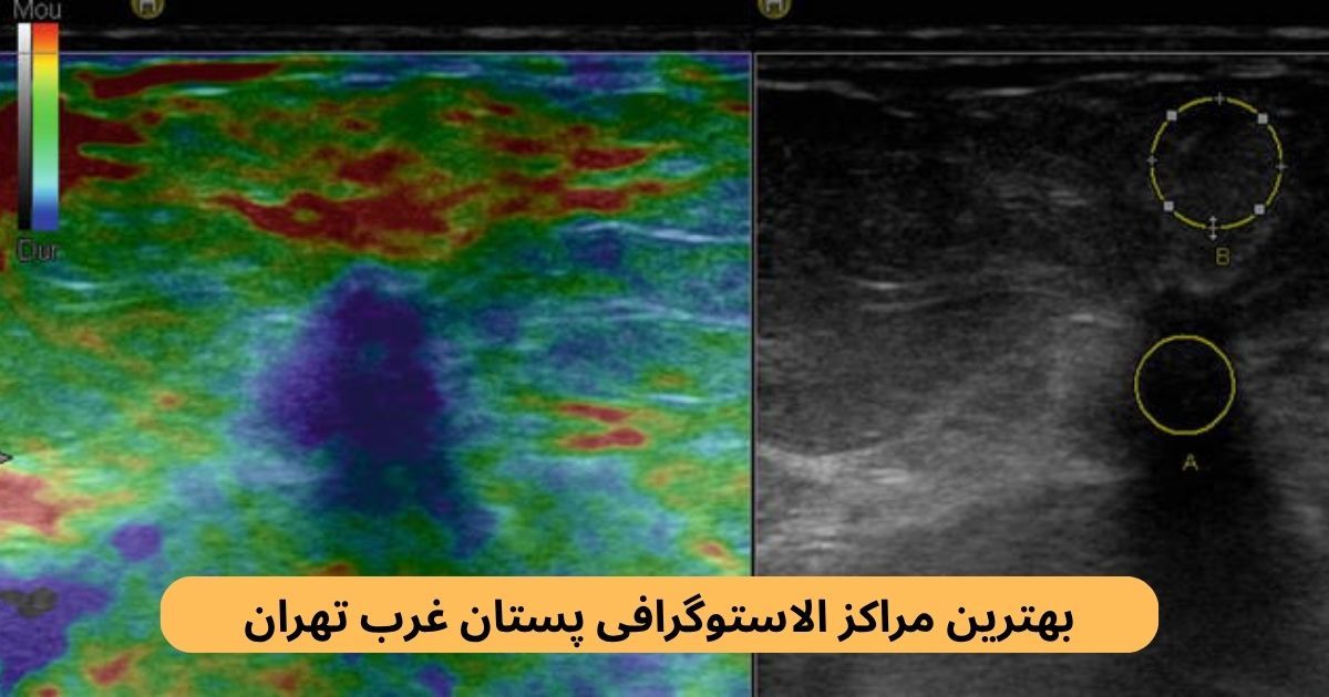 بهترین مراکز الاستوگرافی پستان غرب تهران در این صفحه بهترین مراکز الاستوگرافی پستان غرب تهران را براساس امکان نوبتدهی، رضایت مردم، کیفیت خدمات و غیره دستهبندی کردهایم.