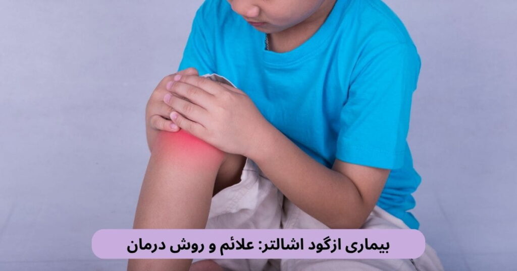 ازگود اشالتر نوعی آسیب ناشی از فشار و کشش مکرر در ناحیه رشد استخوان ساق است. این بیماری در کودکان و نوجوانان در حال رشد شایع است.