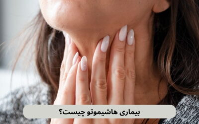 بیماری هاشیموتو چیست؟