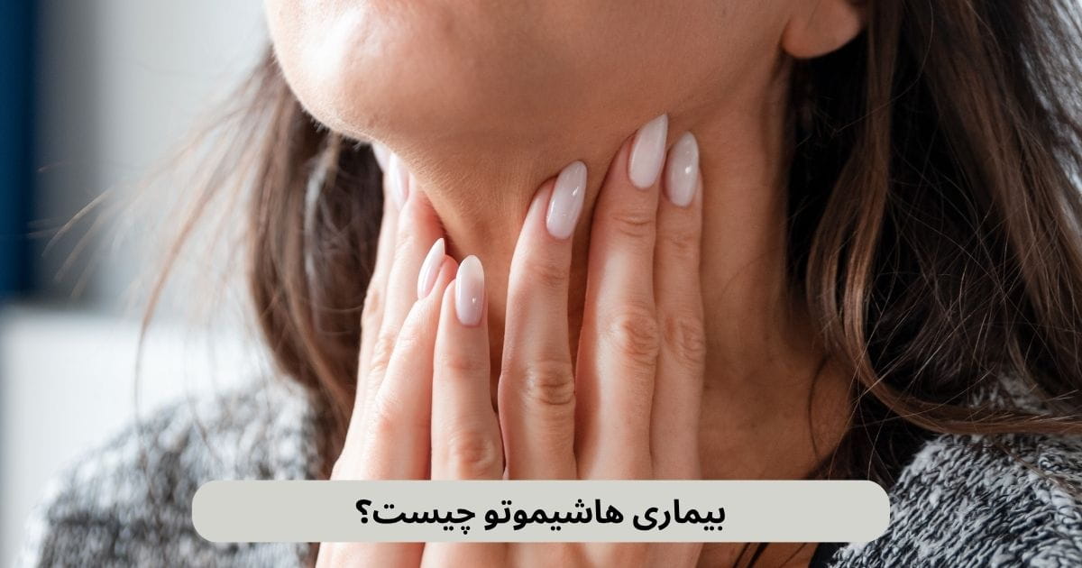 بیماری هاشیموتو، نوعی اختلال خودایمنی است که در آن سلول‌های ایمنی بدن، سلول‌های تولیدکننده هورمون در غده تیروئید را از بین می‌برند.