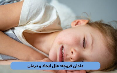 دندان قروچه: علل ایجاد و درمان