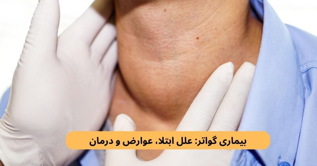 مشاهده برجستگی در قسمت جلوی گردن ممکن است یکی از نشانه‌های بزرگ‌شدن غده تیروئید باشد؛ وضعیتی که به آن گواتر گفته می‌شود.