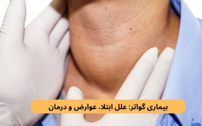 بیماری گواتر: علل ابتلا، عوارض و درمان