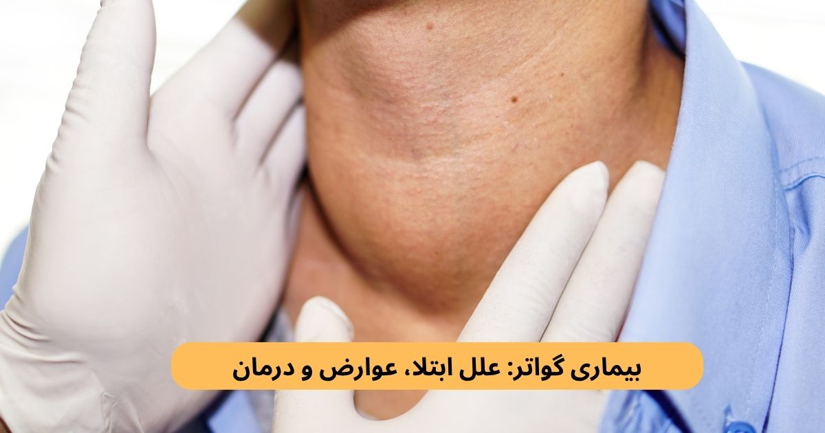 مشاهده برجستگی در قسمت جلوی گردن ممکن است یکی از نشانه‌های بزرگ‌شدن غده تیروئید باشد؛ وضعیتی که به آن گواتر گفته می‌شود.